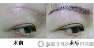 绣眉手法视频,跟随视频学习精湛绣眉手法